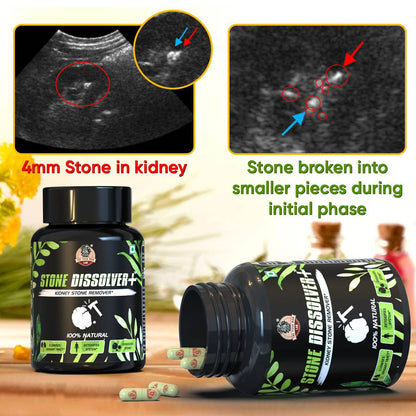 Suplemento Renal   100% Natural